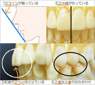 オーバージェット